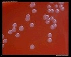 Neisseria gonorrhoeae colonies